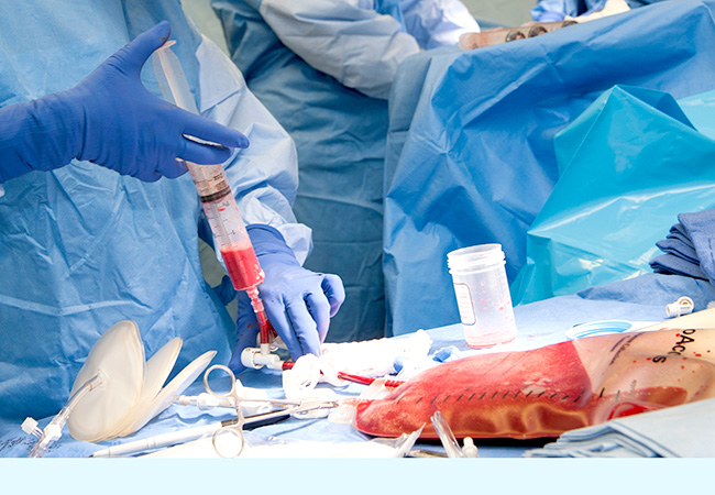 Bone Marrow Transplant Rejection Market